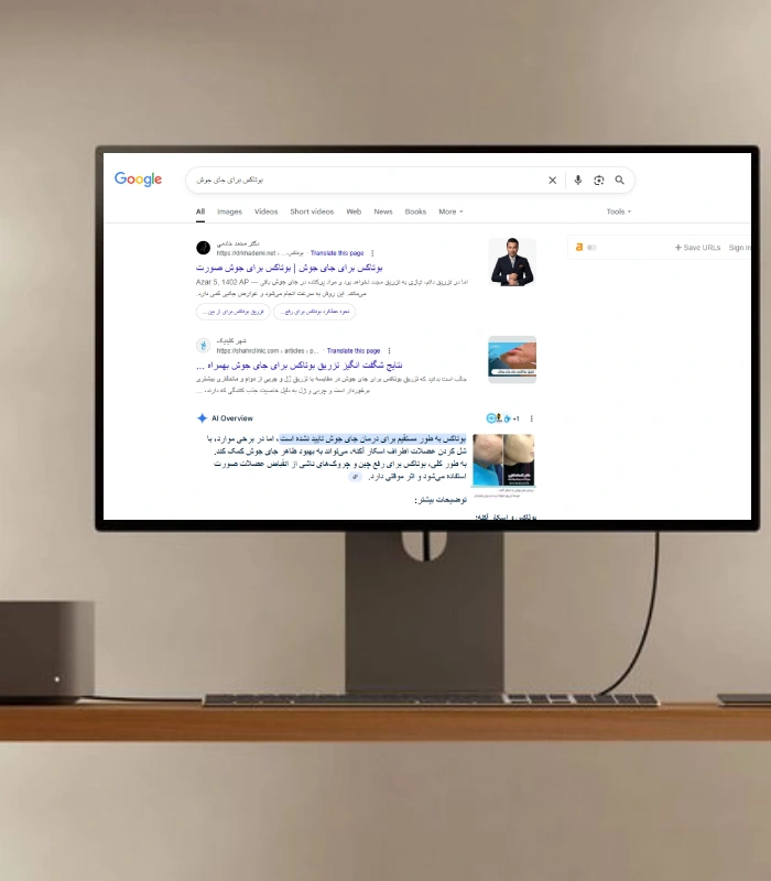افزایش رتبه های یک در نتایج گوگل